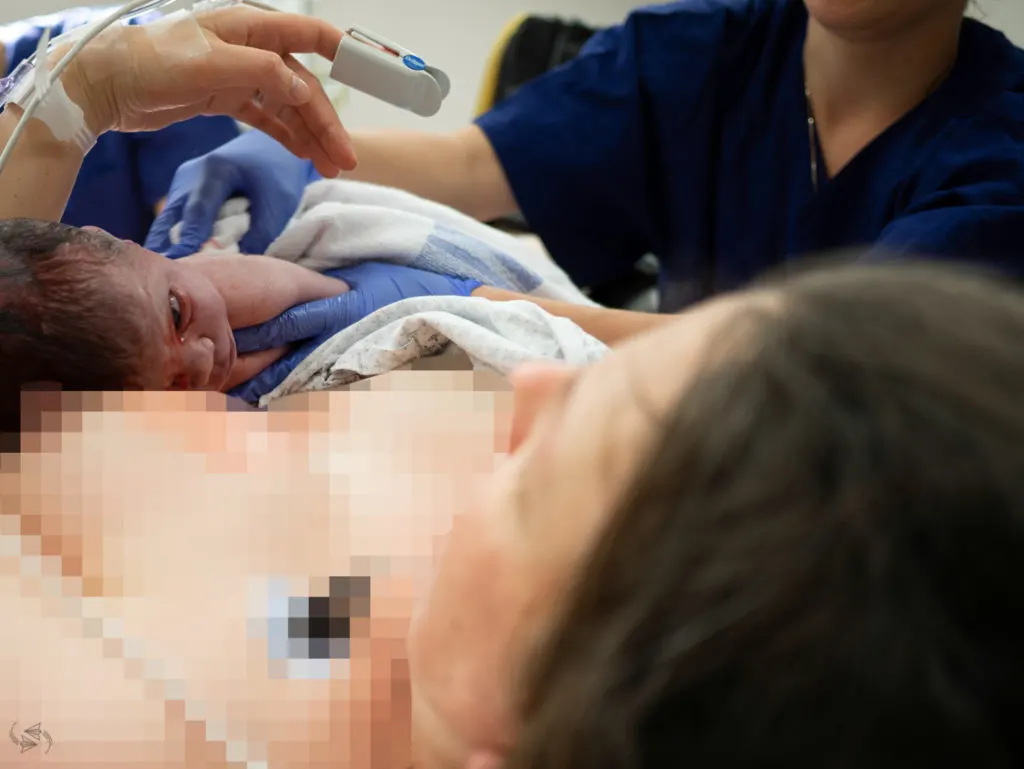 Our daughter laying on me immediately after birth, looking very purple.